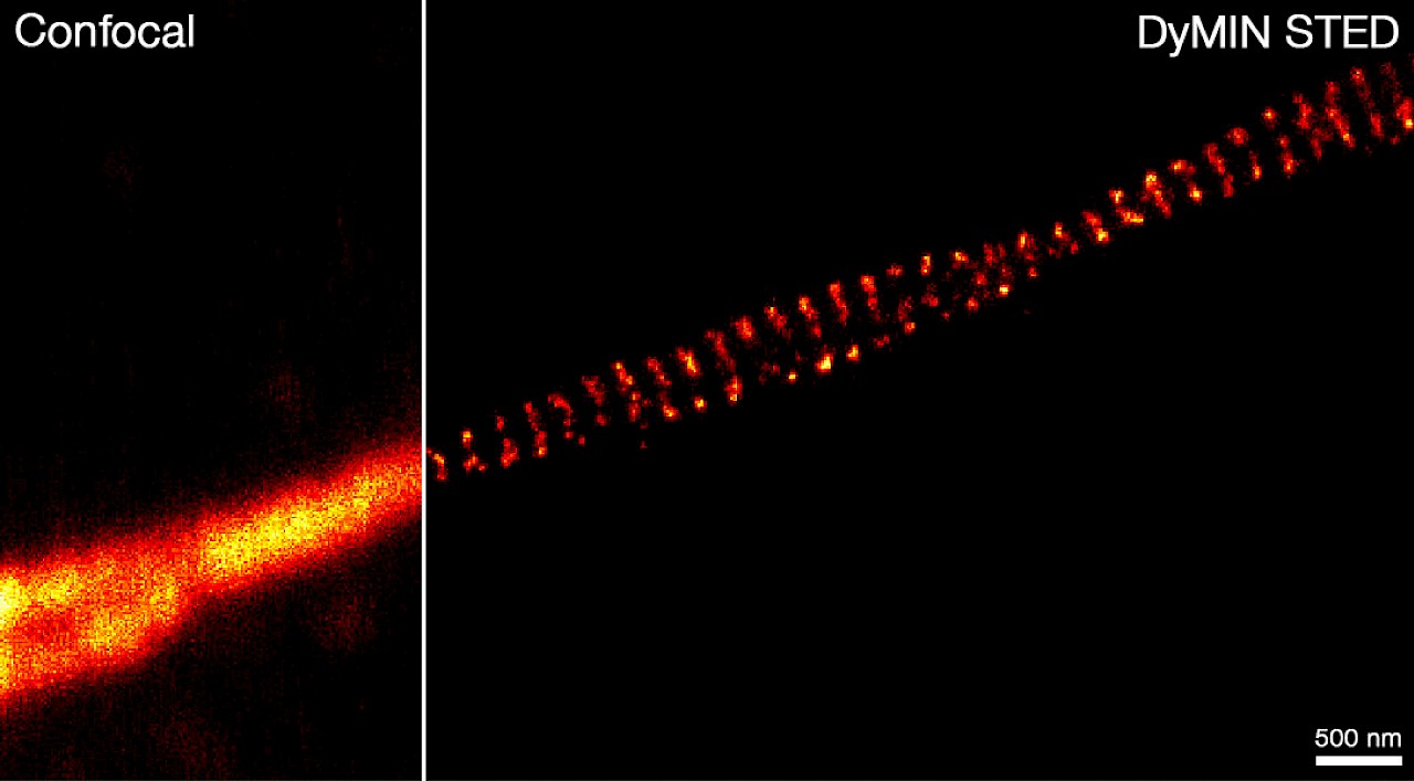 Infinity Line-STED超高分辨率显微镜