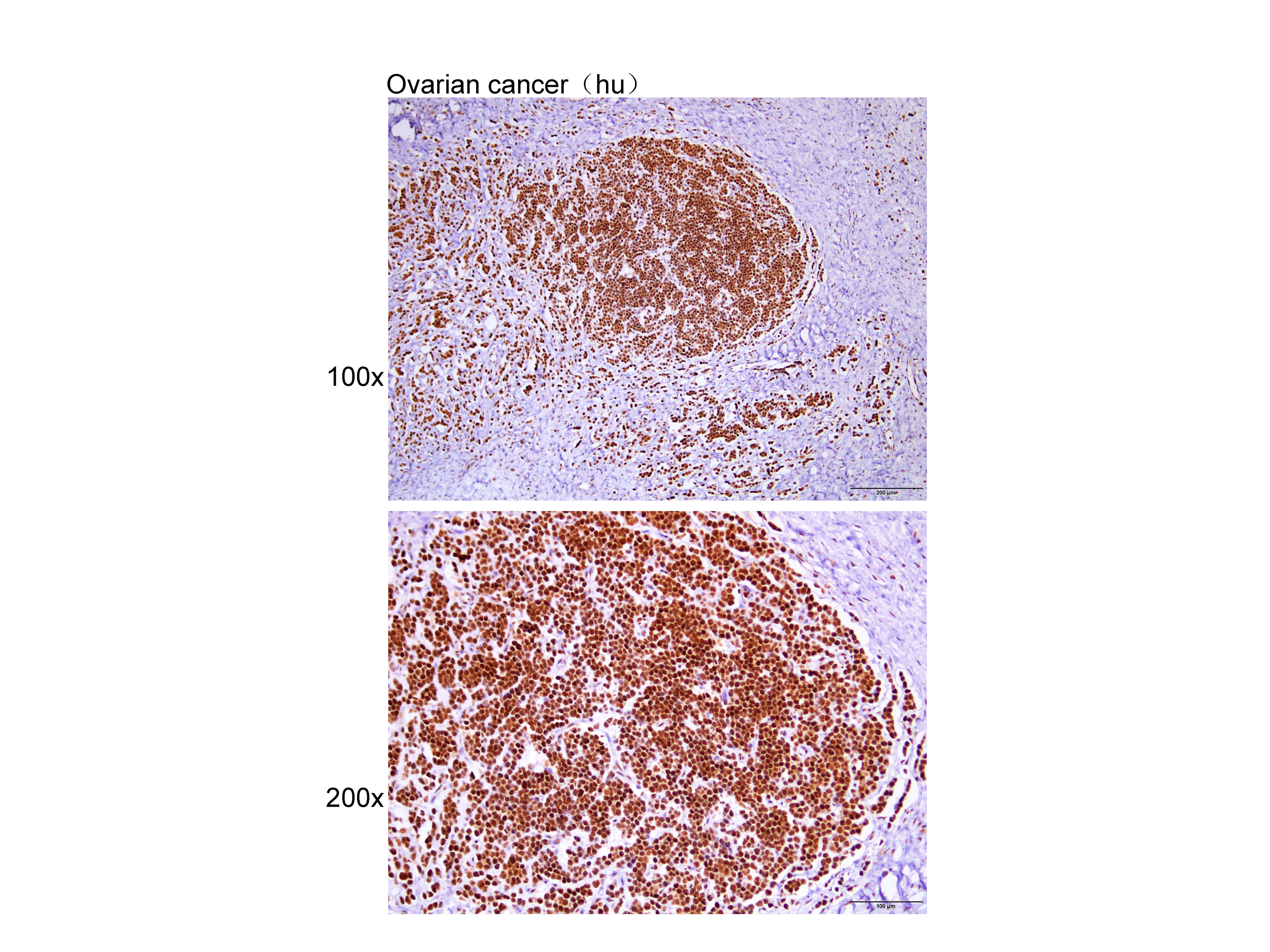 Anti-TRF1 Polyclonal Antibody