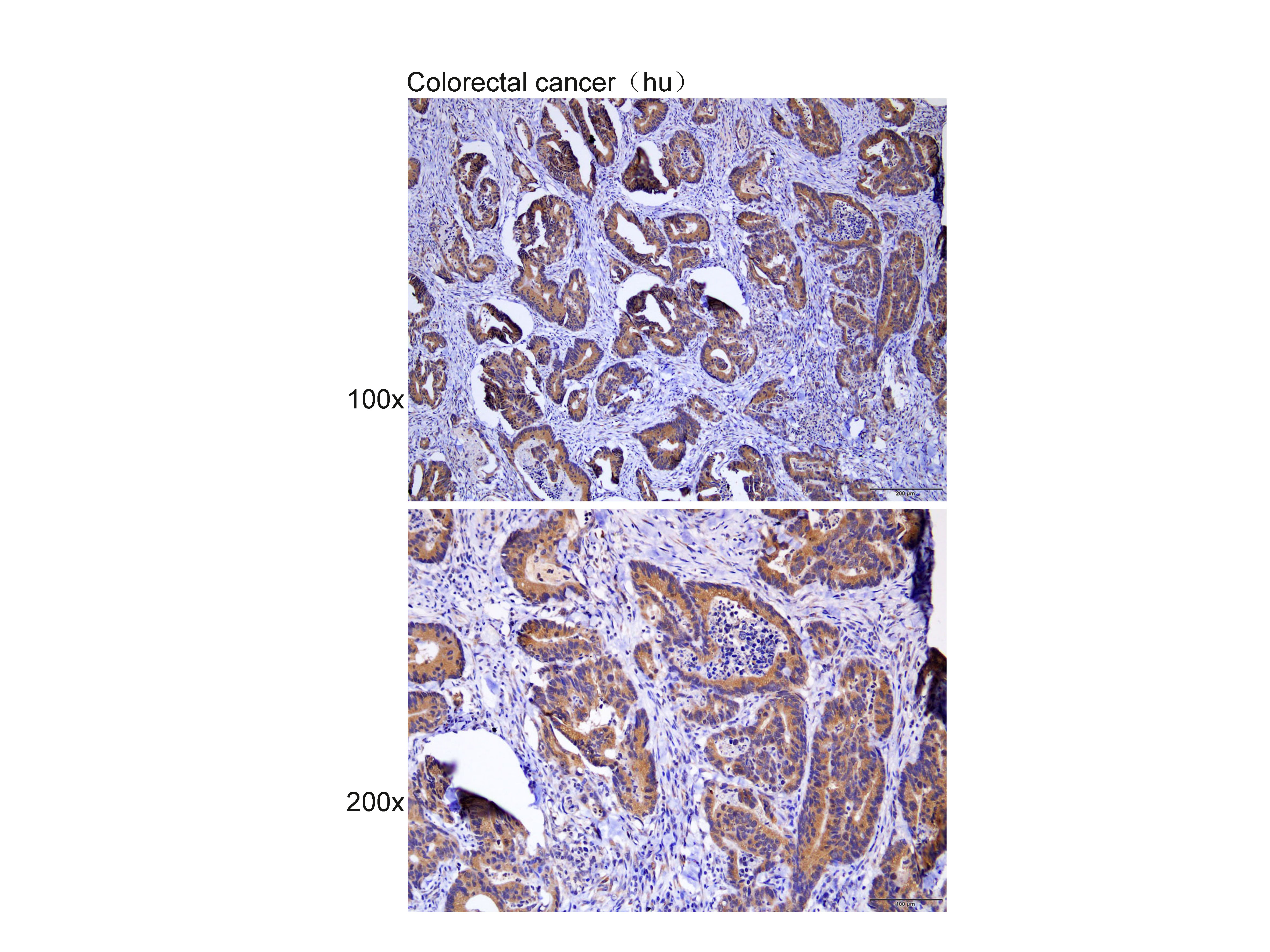 Anti-PIK3R2 Polyclonal Antibod