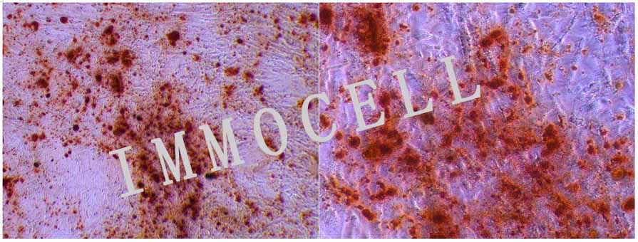 人脐带间充质干细胞（流式鉴定/三系分化）