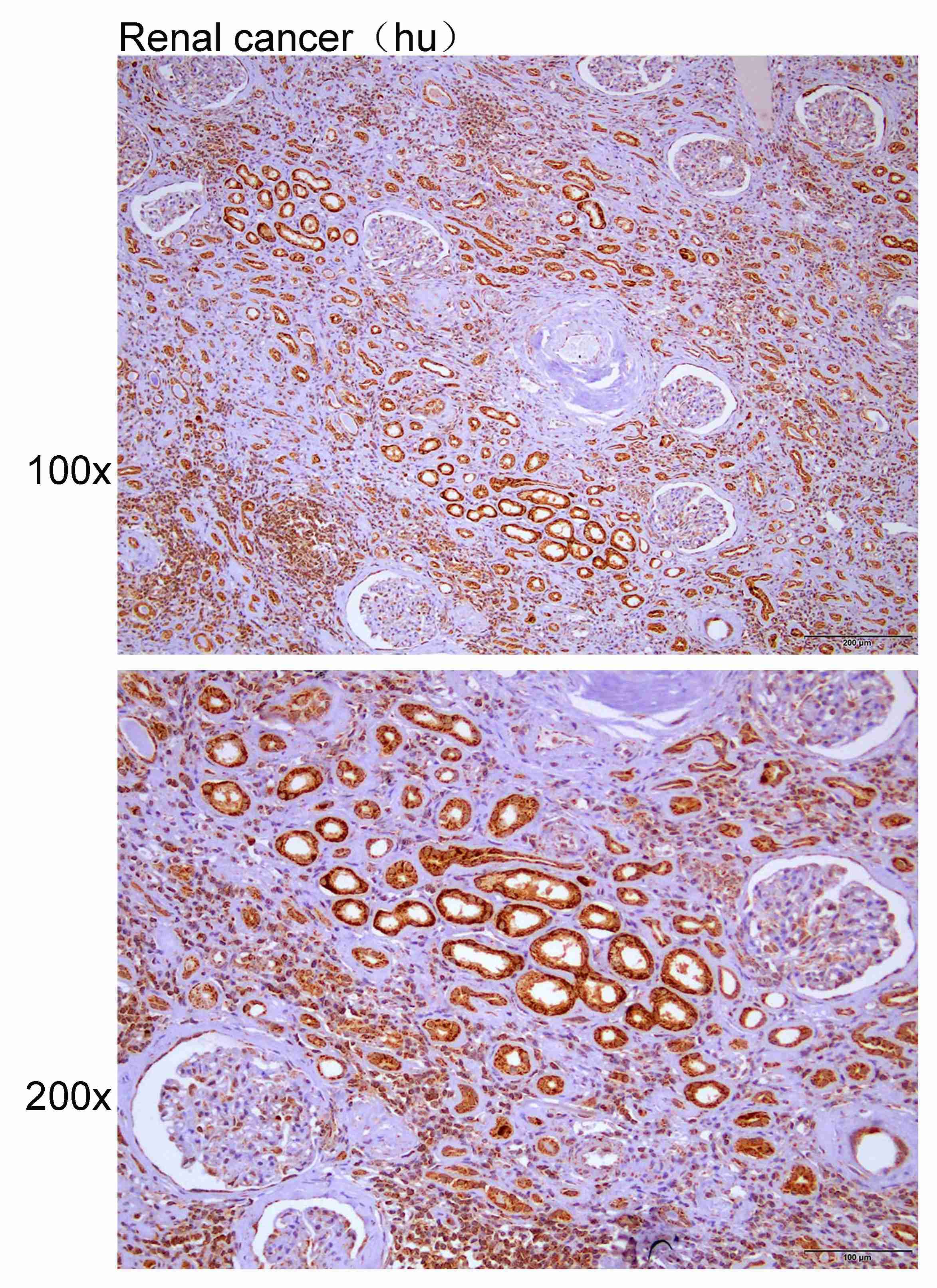 Anti-INHBA Polyclonal Antibody