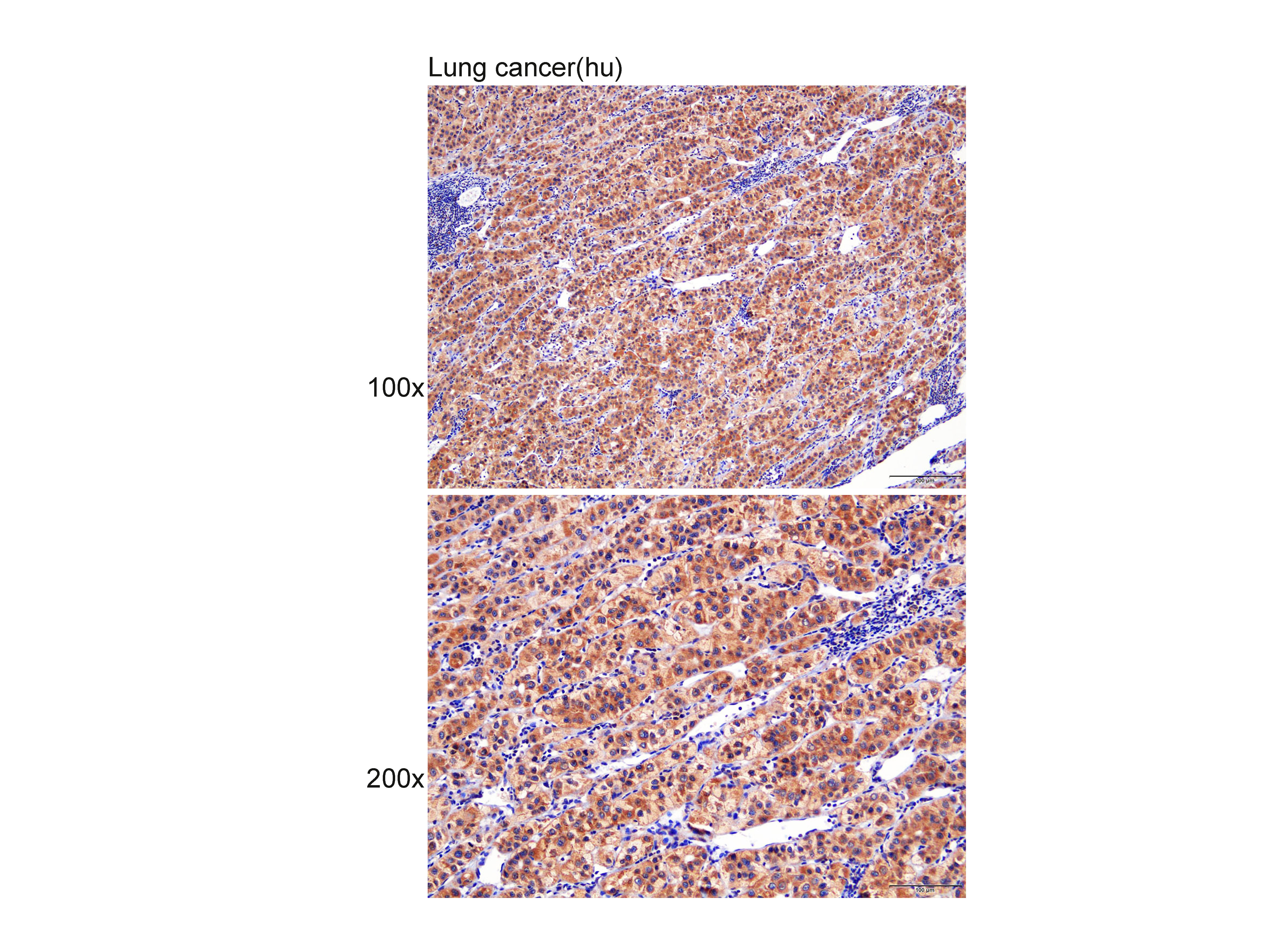 Anti-FZD5 Polyclonal Antibody