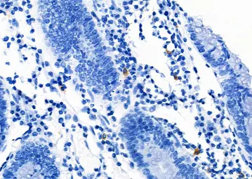 LAT1 / SLC7A5 antibody
