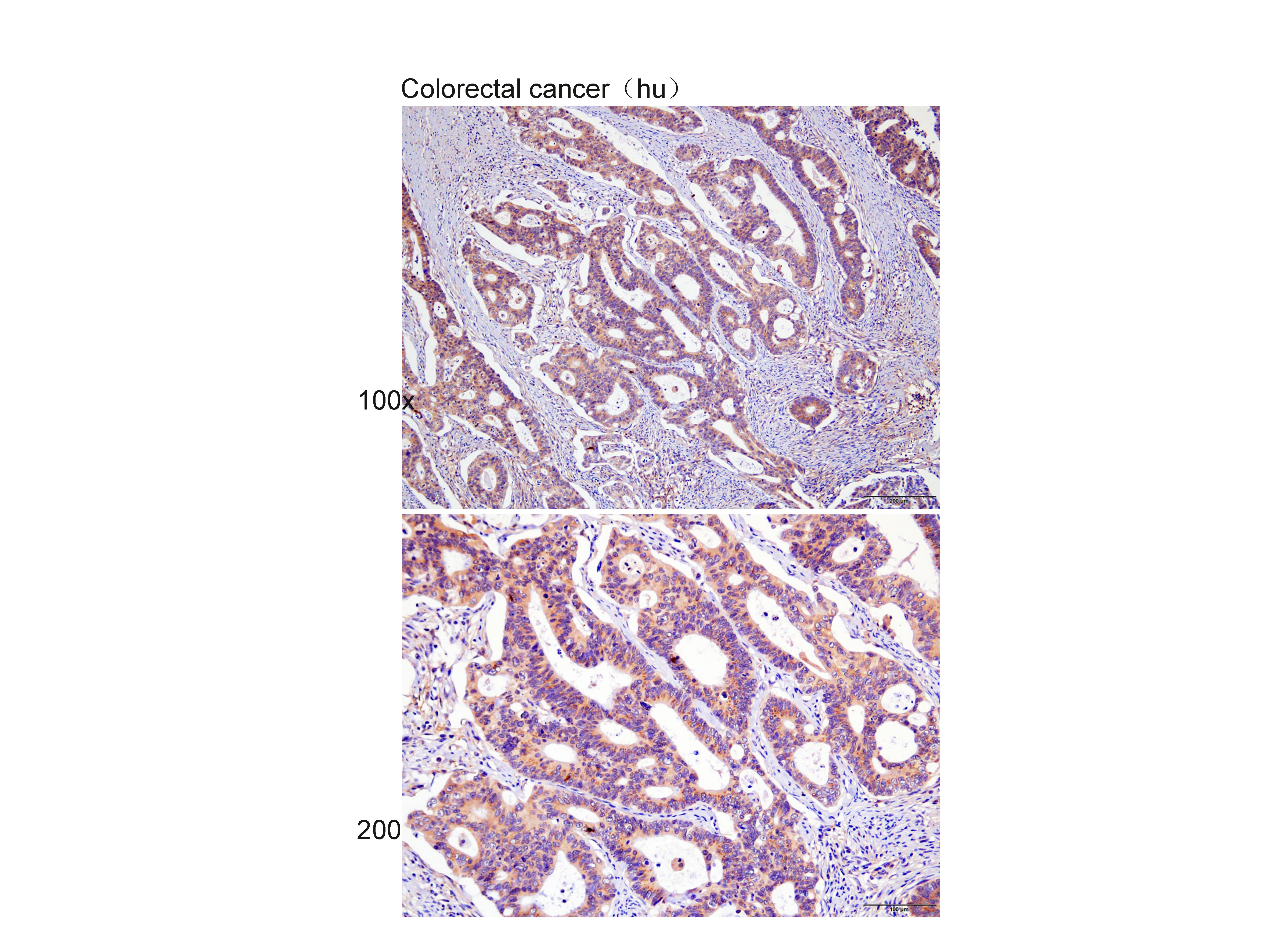 Anti-Visfatin Polyclonal Antib