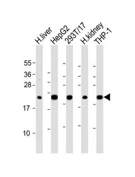 GPX1 antibody