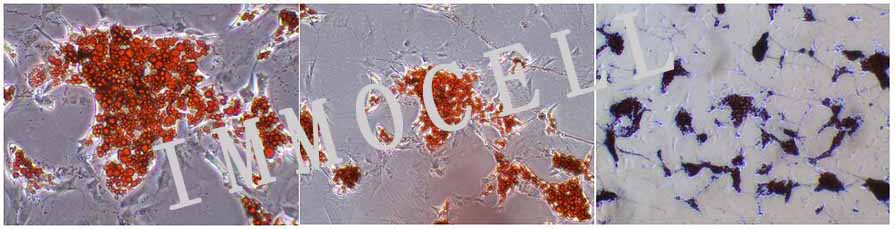 人脐带间充质干细胞（流式鉴定/三系分化）