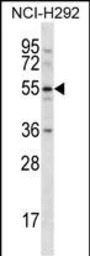 CLEC18A antibody