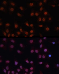 CDKN2A / p16INK4a antibody