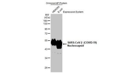SARS-CoV-2 (COVID-19) Nucleoca