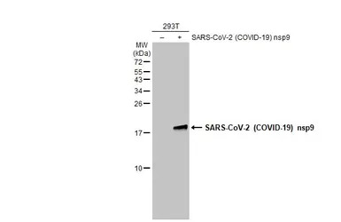 SARS-CoV-2 (COVID-19) nsp9 ant