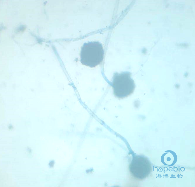 乳酸酚棉蓝染色液