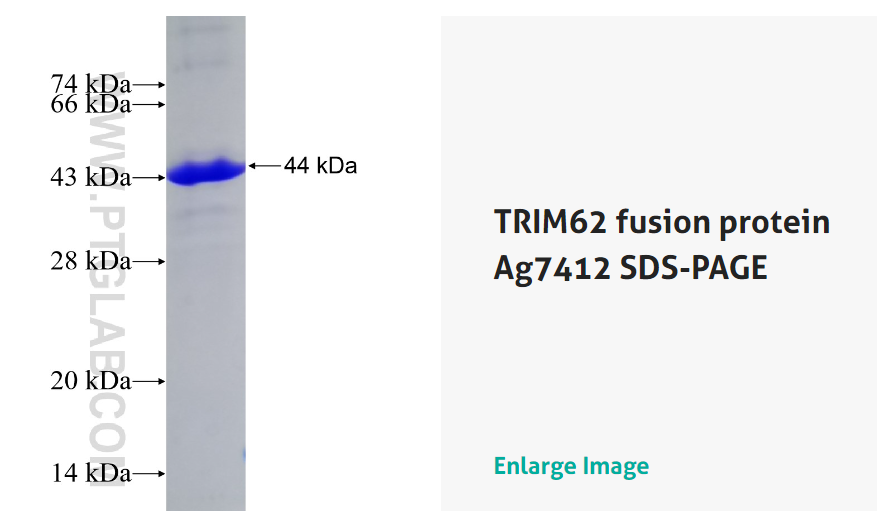 TRIM62 融合蛋白