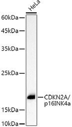 CDKN2A / p16INK4a antibody