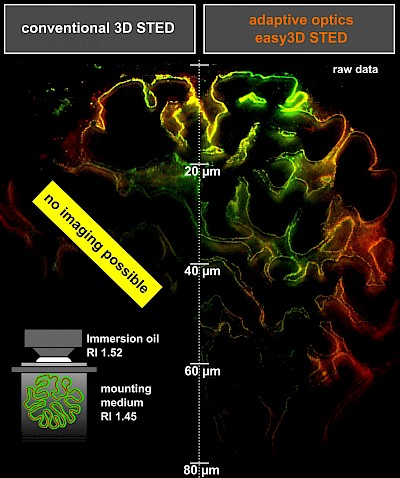 Infinity Line-STED超高分辨率显微镜