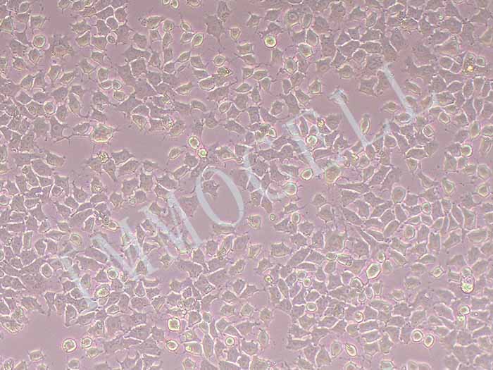 McA-RH7777细胞丨McA-RH7777大鼠肝癌细胞
