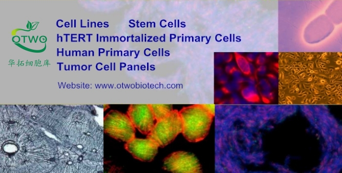 HEK-A人表皮角质细胞|HEK-A细胞|永生化人表皮角质细