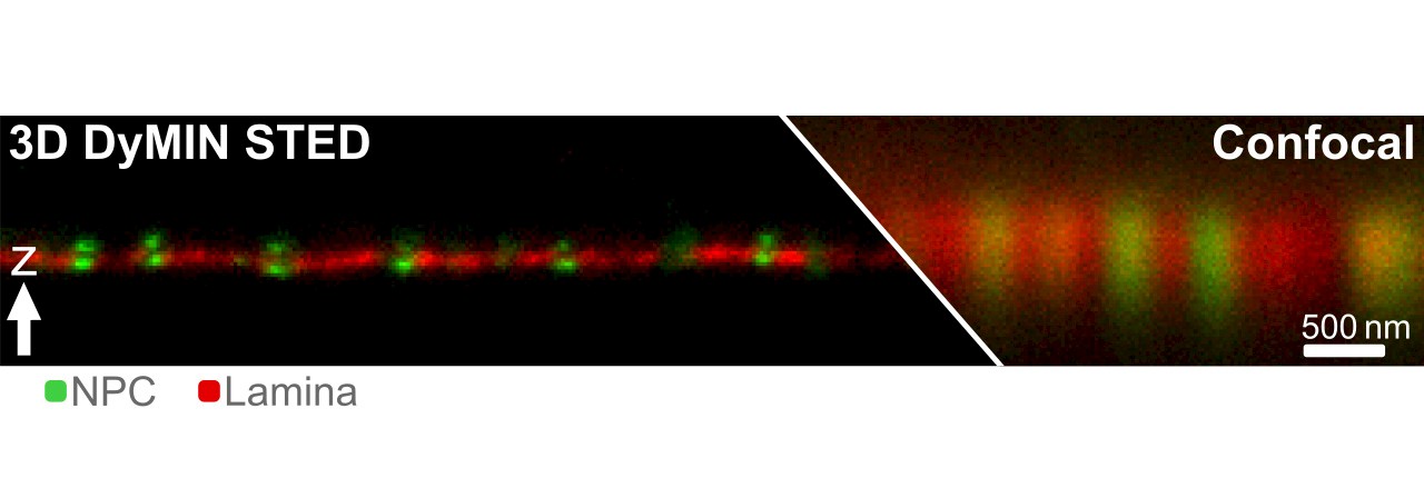 Infinity Line-STED超高分辨率显微镜