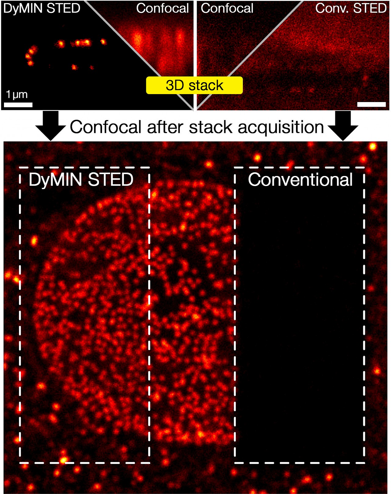 Infinity Line-STED超高分辨率显微镜