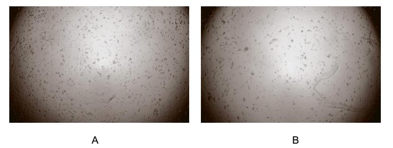 神经生长因子(NGF)活性蛋白