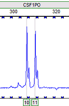 RT112 (人膀胱癌细胞)