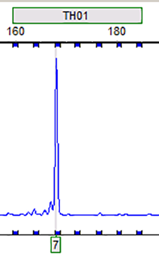 RT112 (人膀胱癌细胞)