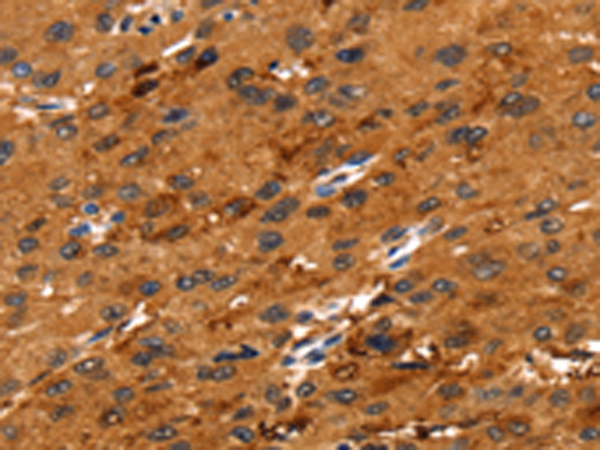 兔抗FGFR3多克隆抗体