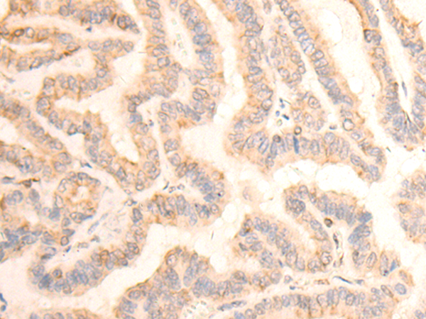 兔抗TUBA1B多克隆抗体