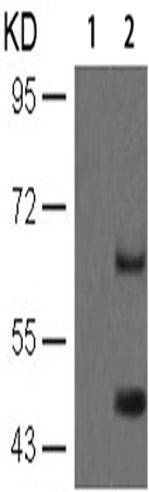 兔抗MAPT(Phospho-Ser396)多克隆抗体