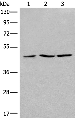 兔抗RPL3多克隆抗体