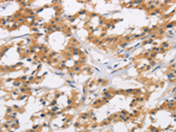 兔抗AXIN2多克隆抗体