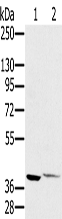 兔抗FCMR多克隆抗体