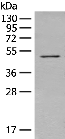 兔抗TUBA1B多克隆抗体