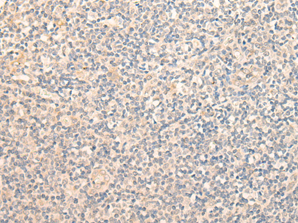 兔抗GCNT3多克隆抗体