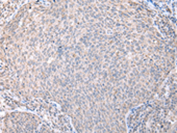 兔抗DYNLL2多克隆抗体