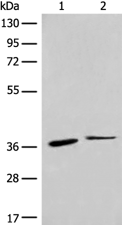 兔抗CCR1多克隆抗体