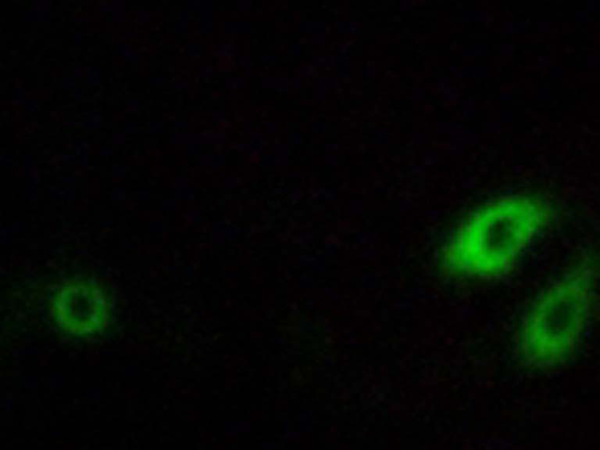 兔抗AKR1CL1多克隆抗体