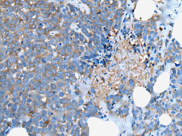 兔抗UGT2B15多克隆抗体