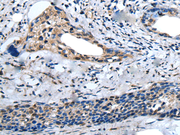 兔抗ZNF37A多克隆抗体