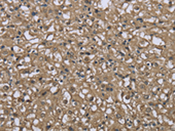 兔抗FBP1多克隆抗体