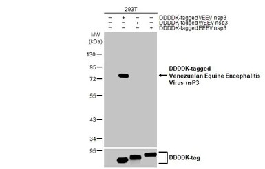 Venezuelan Equine Encephalitis
