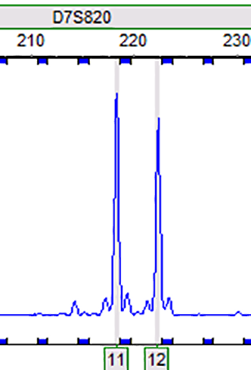 RT112 (人膀胱癌细胞)