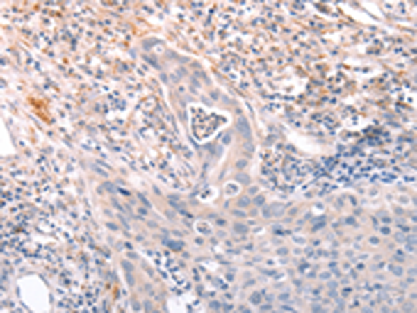 兔抗A4GNT多克隆抗体