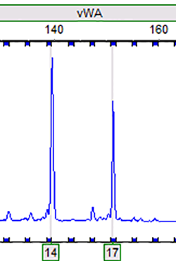 RT112 (人膀胱癌细胞)