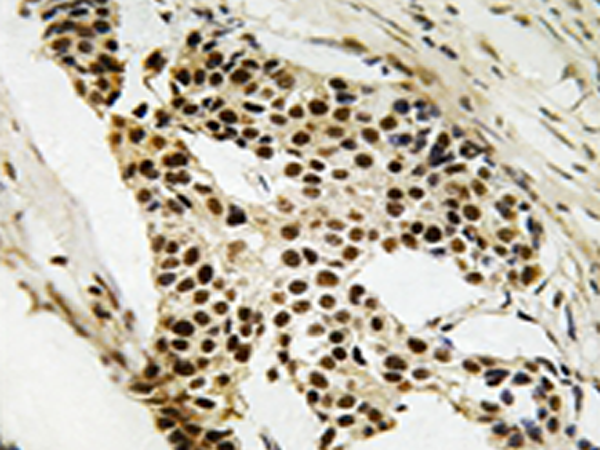 兔抗MAPKAPK2(Ab-272) 多克隆抗体