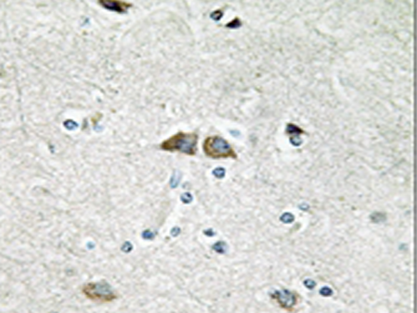 兔抗RPL39L多克隆抗体