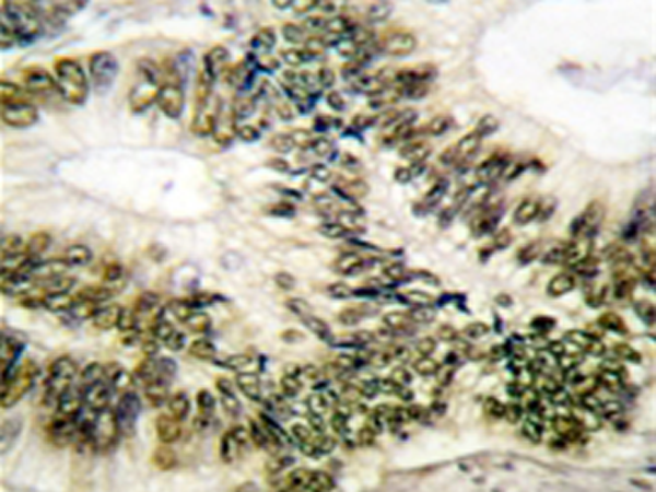 兔抗CCNE1(Ab-395)多克隆抗体