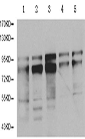 兔抗ARNT多克隆抗体