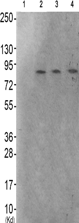 兔抗GAB2(Phospho-Ser623) 多克隆抗体