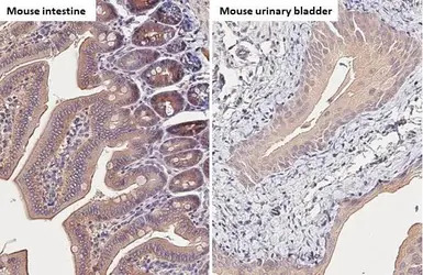 Carbonic Anhydrase IX antibody