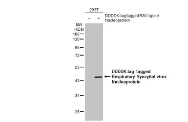 Respiratory Syncytial virus Nu